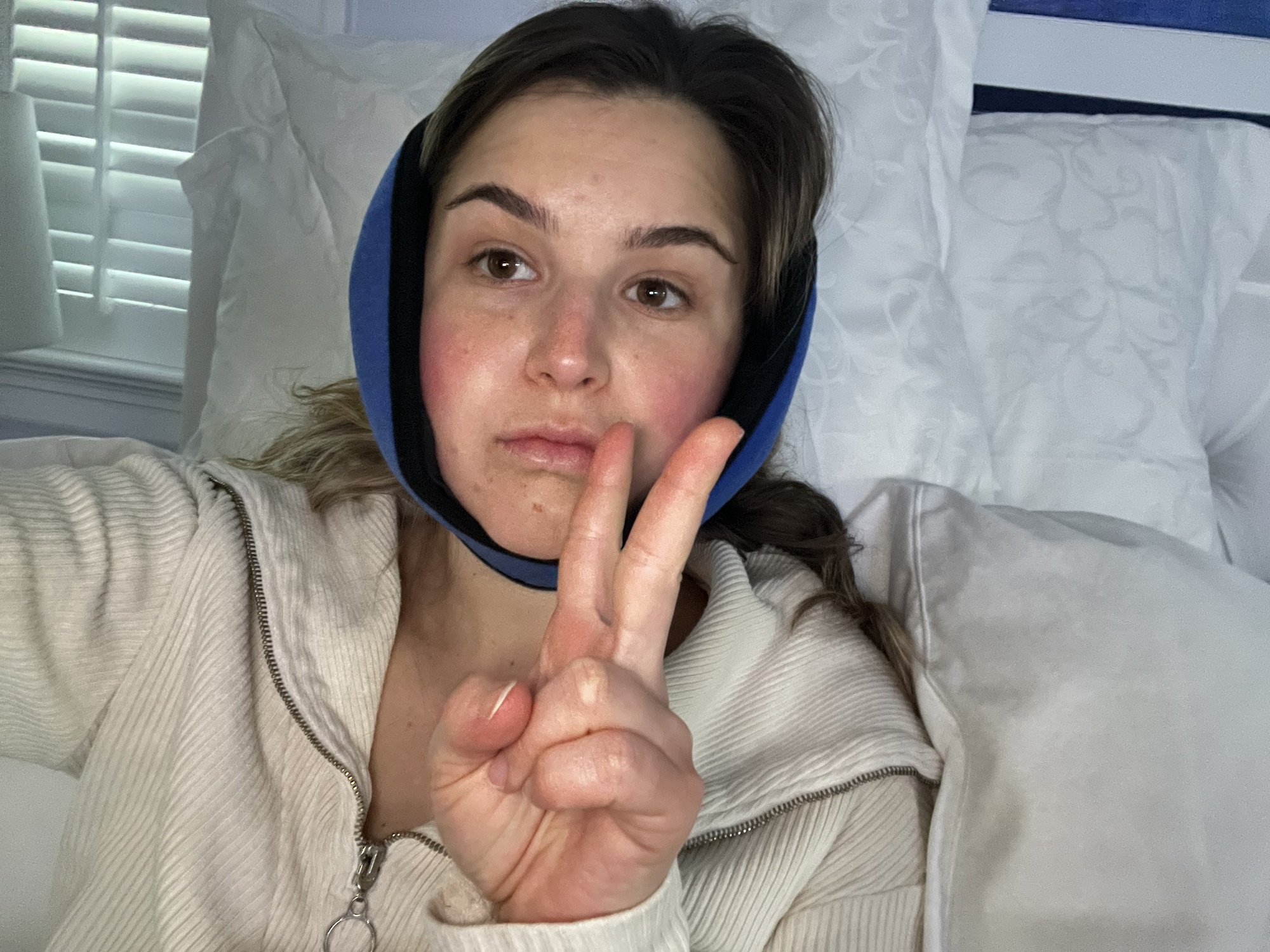 Getting My Wisdom Teeth Pulled! (With timeline and tips!)